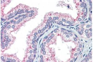 Human Prostate (formalin-fixed, paraffin-embedded) stained with NAB1 antibody ABIN462173 followed by biotinylated goat anti-rabbit IgG secondary antibody ABIN481713, alkaline phosphatase-streptavidin and chromogen.