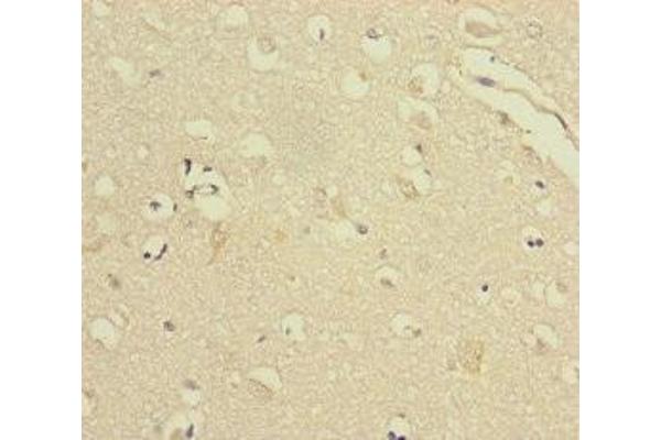 VPS33B antibody  (AA 348-617)