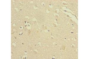 Immunohistochemistry of paraffin-embedded human brain tissue using ABIN7175312 at dilution of 1:100 (VPS33B antibody  (AA 348-617))