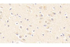 Detection of APOE in Human Cerebrum Tissue using Polyclonal Antibody to Apolipoprotein E (APOE)
