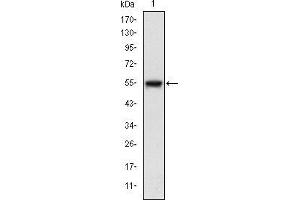 Western blot analysis using MAP3K5 mAb against human MAP3K5 (AA: 922-1108) recombinant protein.