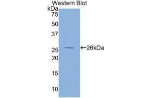 Western blot analysis of the recombinant protein. (FOLR1 antibody  (AA 26-229))