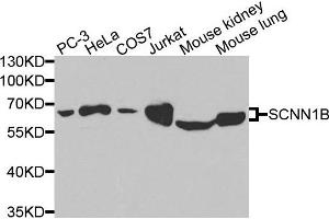 Western blot analysis of extracts of various cells, using SCNN1B antibody. (SCNN1B antibody)