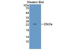 Western Blotting (WB) image for anti-Growth Arrest and DNA-Damage-Inducible, alpha (GADD45A) (AA 1-165) antibody (ABIN1868086) (GADD45A antibody  (AA 1-165))