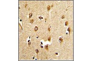 Immunohistochemistry analysis in Formalin Fixed, Paraffin Embedded Human brain tissue stained with ABI1 Antibody (N-term) Cat.