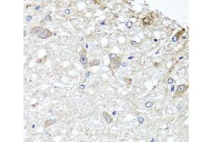 Immunohistochemistry of paraffin-embedded Rat brain using METTL13 Polyclonal Antibody at dilution of 1:100 (40x lens). (METTL13 antibody)
