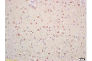 Formalin-fixed and paraffin embedded rat brain labeled with Rabbit Anti Phospho-p57 Kip2 (Thr310) Polyclonal Antibody, Unconjugated (ABIN703045) at 1:200 followed by conjugation to the secondary antibody and DAB staining (CDKN1C antibody  (pThr310))