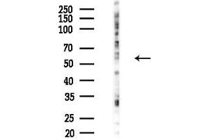 Western blot analysis of lysates from K562 cells(UV 30 min treatment), using Phospho-MEF2A (Thr319) Antibody at 1/1000 dilution.