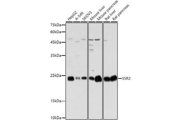 SSR2 antibody