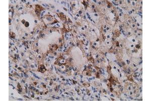 Immunohistochemical staining of paraffin-embedded Human liver tissue using anti-SDR9C7 mouse monoclonal antibody. (SDR9C7 antibody)