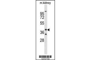 Western blot analysis of FOXL1 Antibody in mouse kidney tissue lysates (35ug/lane) (FOXL1 antibody  (AA 94-119))
