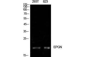 Western Blot (WB) analysis of 293T, 823 cells using Epigen Polyclonal Antibody. (Epigen antibody  (Internal Region))