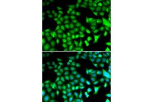 Immunofluorescence analysis of HeLa cells using FOSL1 antibody (ABIN5973108). (FOSL1 antibody)