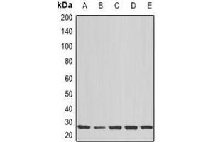 Western blot analysis of COX2 expression in Hela (A), MCF7 (B), Jurkat (C), mouse brain (D), rat brain (E) whole cell lysates. (COX2 antibody)