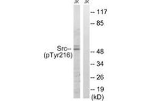 Western blot analysis of extracts from Jurkat cells treated with EGF 200ng/ml 5', using Src (Phospho-Tyr216) Antibody. (Src antibody  (pTyr216))