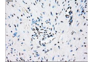 Image no. 12 for anti-Crystallin, alpha B (CRYAB) antibody (ABIN1497647) (CRYAB antibody)