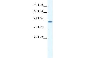 CATSPER2 antibody used at 1. (CATSPER2 antibody  (N-Term))