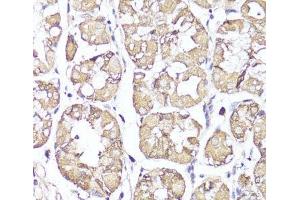 Immunohistochemistry of paraffin-embedded Human stomach using OPRK1 Polyclonal Antibody at dilution of 1:100 (40x lens). (OPRK1 antibody)