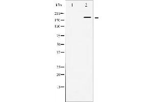 Western blot analysis of WNK1 expression in EGF treated 293 whole cell lysates,The lane on the left is treated with the antigen-specific peptide. (WNK1 antibody  (N-Term))