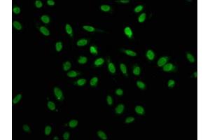 Immunofluorescence staining of Hela cells with ABIN7155098 at 1:100, counter-stained with DAPI. (HNRNPA1 antibody  (AA 2-354))