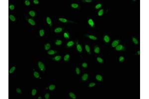Immunofluorescence staining of Hela cells with ABIN7155098 at 1:100, counter-stained with DAPI. (HNRNPA1 antibody  (AA 2-354))