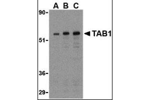 Western Blotting (WB) image for anti-TGF-beta Activated Kinase 1/MAP3K7 Binding Protein 1 (TAB1) (Middle Region) antibody (ABIN1031115) (TAB1 antibody  (Middle Region))