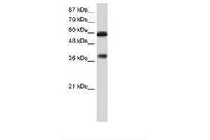 Image no. 1 for anti-AT Rich Interactive Domain 3B (BRIGHT-Like) (ARID3B) (C-Term) antibody (ABIN6736169) (ARID3B antibody  (C-Term))