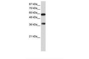 Image no. 1 for anti-AT Rich Interactive Domain 3B (BRIGHT-Like) (ARID3B) (C-Term) antibody (ABIN6736169)