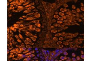 Immunofluorescence analysis of Rat testis using LDHC Polyclonal Antibody at dilution of 1:100 (40x lens). (Lactate Dehydrogenase C antibody)