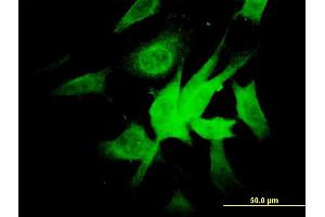 Immunofluorescence of monoclonal antibody to NDUFA9 on NIH/3T3 cell. (NDUFA9 antibody  (AA 303-377))