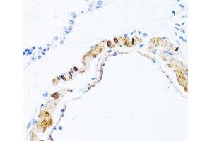 Immunohistochemistry of paraffin-embedded Rat lung using PHPT1 Polyclonal Antibody at dilution of 1:100 (40x lens). (PHPT1 antibody)