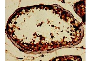 Immunohistochemistry of paraffin-embedded human testis tissue using ABIN7162483 at dilution of 1:100 (SIN3A antibody  (AA 1-123))