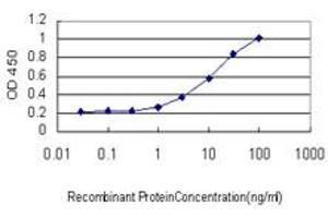 Detection limit for recombinant GST tagged IL1RAPL1 is approximately 0. (IL1RAPL1 antibody  (AA 151-250))
