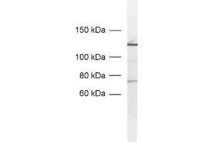 dilution: 1 : 1000, sample: nuclear extracts from PC12 cells (SF3A1 antibody)