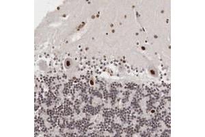 Immunohistochemical staining of human cerebellum with DACH2 polyclonal antibody  shows distinct nuclear positivity in cerebellar tissue at 1:50-1:200 dilution. (DACH2 antibody  (AA 215-333))