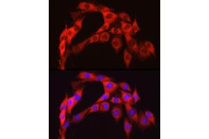 Immunofluorescence analysis of PC-12 cells using S6 Ribosomal Protein (RPS6) Rabbit pAb (ABIN6133901, ABIN6147227, ABIN6147228 and ABIN6221687) at dilution of 1:100 (40x lens). (RPS6 antibody  (AA 1-100))