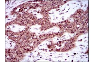 Immunohistochemistry (IHC) image for anti-Sex Determining Region Y (SRY) (AA 1-204) antibody (ABIN1846456) (SRY antibody  (AA 1-204))