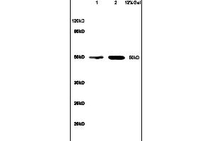 Lane 1: mouse brain lysates Lane 2: human colon carcinoma lysates probed with Anti-BCL3 Polyclonal Antibody, Unconjugated (ABIN718541) at 1:200 in 4C. (BCL3 antibody  (AA 341-454))