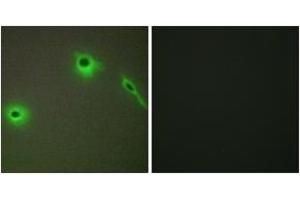 Immunofluorescence analysis of A549 cells, using Collagen XVIII alpha1 Antibody.