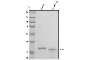 anti-Purkinje Cell Protein 2 (PCP2) (N-Term) antibody