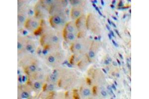 Used in DAB staining on fromalin fixed paraffin-embedded Liver tissue (Insulin Receptor antibody  (AA 1027-1364))