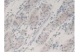 Figure. (TGFB3 antibody  (AA 24-300))