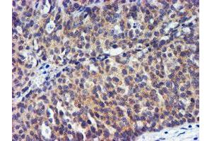 Image no. 4 for anti-Metalloproteinase Inhibitor 2 (TIMP2) antibody (ABIN1501394) (TIMP2 antibody)