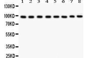 Anti- TFRC antibody, Western blotting All lanes: Anti TRFC  at 0. (Transferrin Receptor antibody  (AA 1-198))