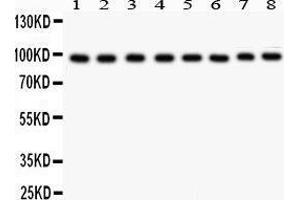 Anti- TFRC antibody, Western blotting All lanes: Anti TRFC  at 0.