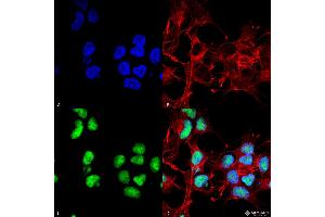 Immunocytochemistry/Immunofluorescence analysis using Rabbit Anti-Choline Acetyltransferase Polyclonal Antibody . (Choline Acetyltransferase antibody  (N-Term) (FITC))