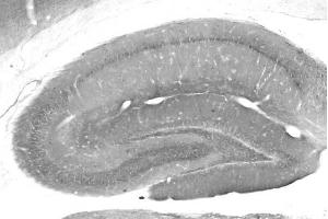 Adult rat hippocampus immunohistochemistry.