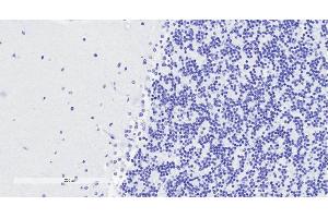 Immunohistochemistry (IHC) image for anti-Doublecortin (DCX) (AA 232-242) antibody (ABIN625829)