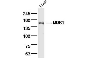 Western Blotting (WB) image for anti-ATP-Binding Cassette, Sub-Family B (MDR/TAP), Member 1B (ABCB1B) (AA 21-100) antibody (ABIN670161)