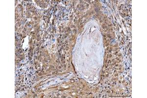 IHC analysis of MRE11 using anti-MRE11 antibody (ABIN7601056). (Mre11 antibody  (AA 278-498))